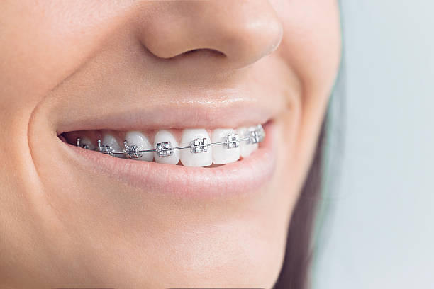 Full Mouth Reconstruction in Orangeburg, NY